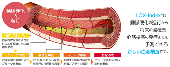 LOX-index