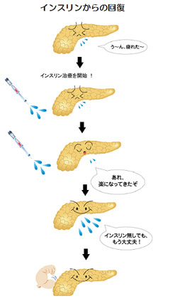 インスリンからの回復
