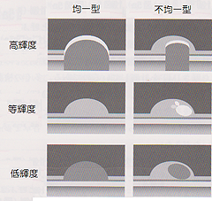 頚動脈